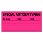 SPECIAL ANTIGEN TYPING Labels